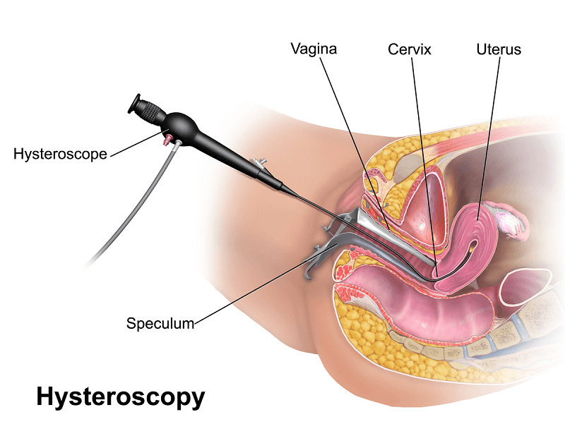 Spotting While In Menopause 2024