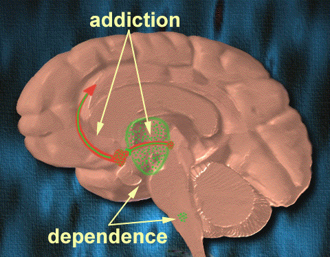 Dependence Vs. Addiction: What Is The Difference? | Betterhelp