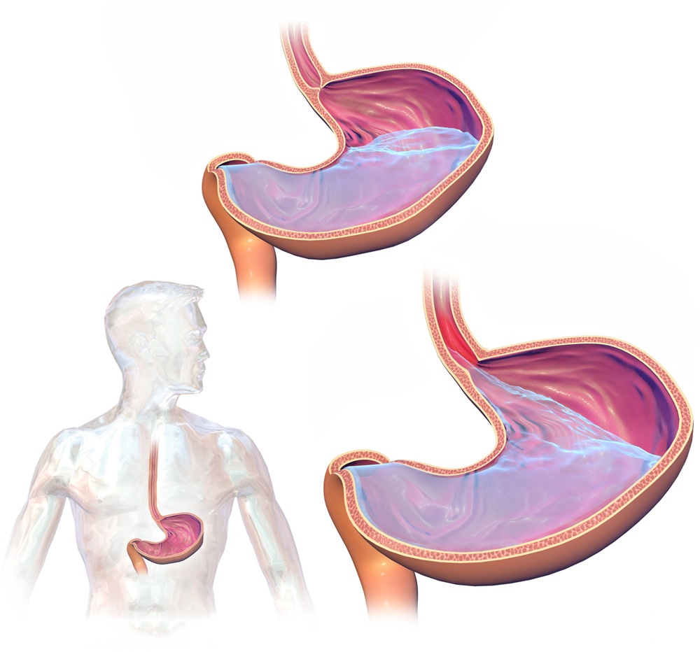 Anxiety In Upper Stomach